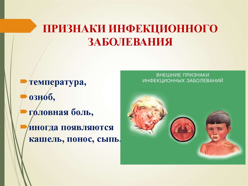 ПРИЗНАКИ ИНФЕКЦИОННОГО ЗАБОЛЕВАНИЯ