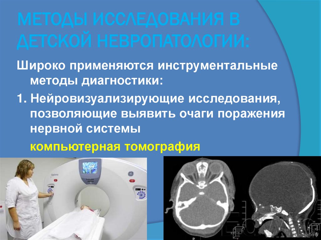 МЕТОДЫ ИССЛЕДОВАНИЯ В ДЕТСКОЙ НЕВРОПАТОЛОГИИ: