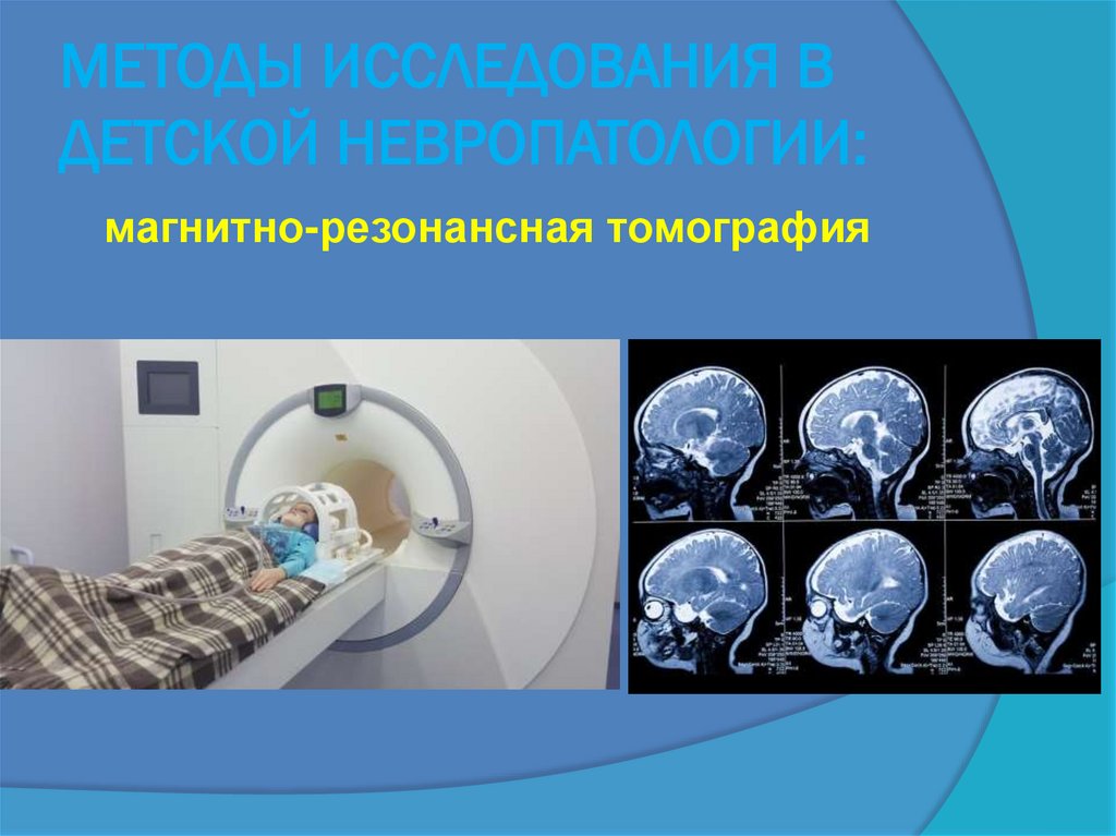 МЕТОДЫ ИССЛЕДОВАНИЯ В ДЕТСКОЙ НЕВРОПАТОЛОГИИ: