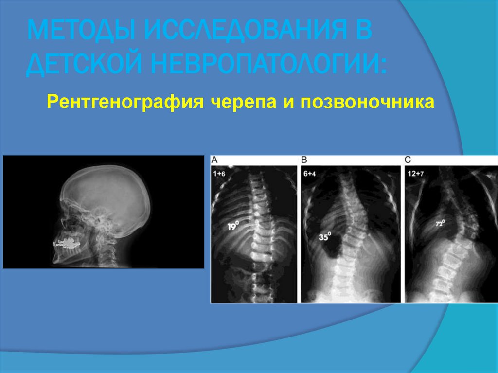 МЕТОДЫ ИССЛЕДОВАНИЯ В ДЕТСКОЙ НЕВРОПАТОЛОГИИ: