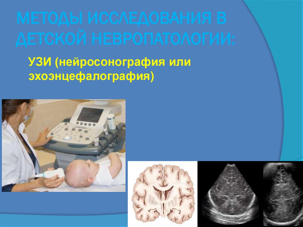 МЕТОДЫ ИССЛЕДОВАНИЯ В ДЕТСКОЙ НЕВРОПАТОЛОГИИ: