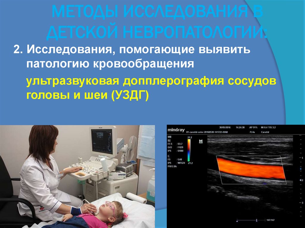 МЕТОДЫ ИССЛЕДОВАНИЯ В ДЕТСКОЙ НЕВРОПАТОЛОГИИ: