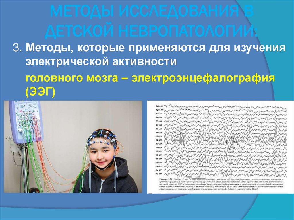 МЕТОДЫ ИССЛЕДОВАНИЯ В ДЕТСКОЙ НЕВРОПАТОЛОГИИ: