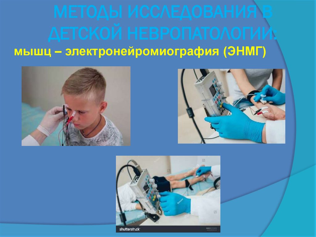 МЕТОДЫ ИССЛЕДОВАНИЯ В ДЕТСКОЙ НЕВРОПАТОЛОГИИ: