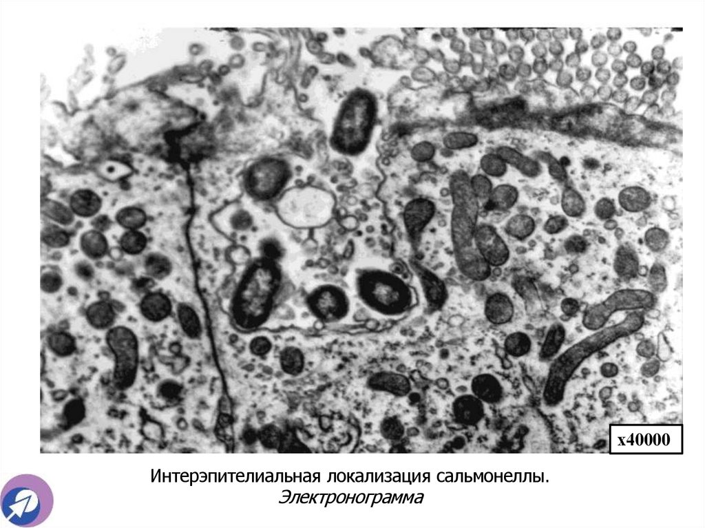Интерэпителиальная локализация сальмонеллы. Электронограмма