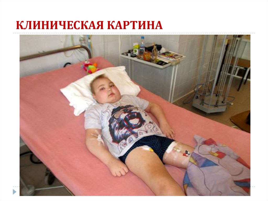 КЛИНИЧЕСКАЯ КАРТИНА