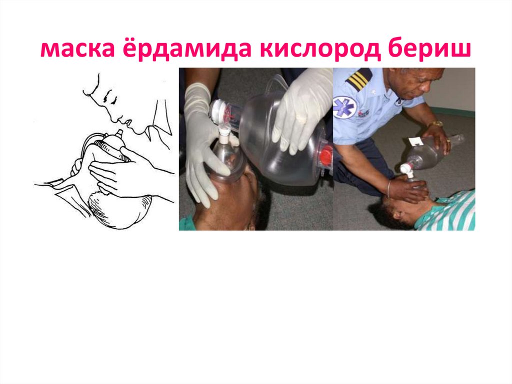 маска ёрдамида кислород бериш