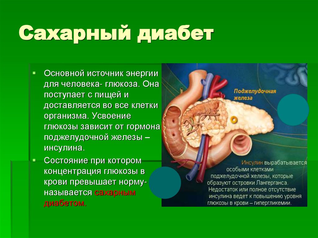 Сахарный диабет