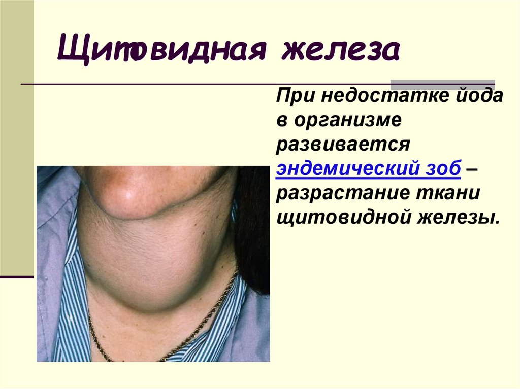 Щитовидная железа