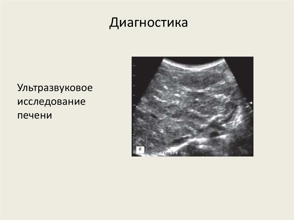 Диагностика