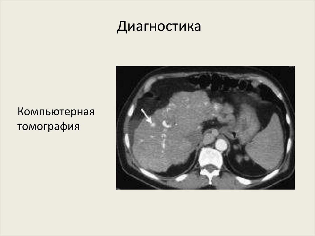 Диагностика