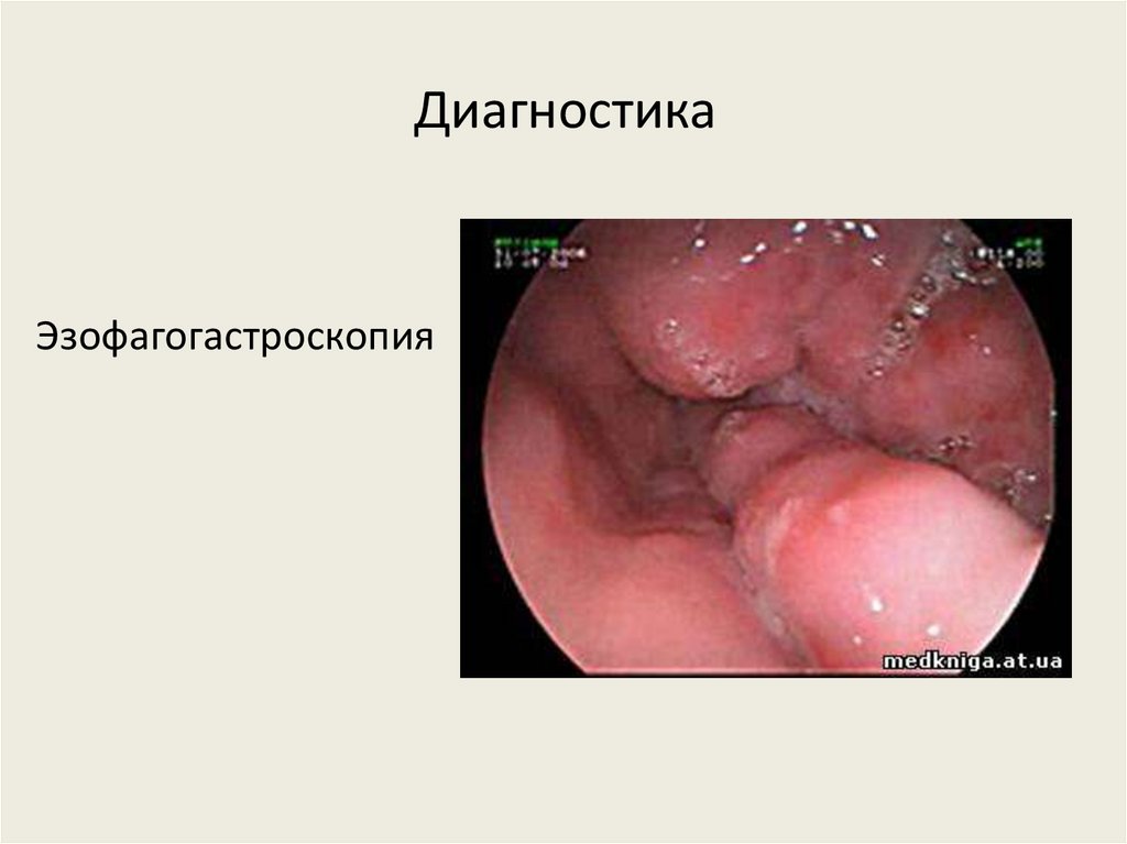 Диагностика