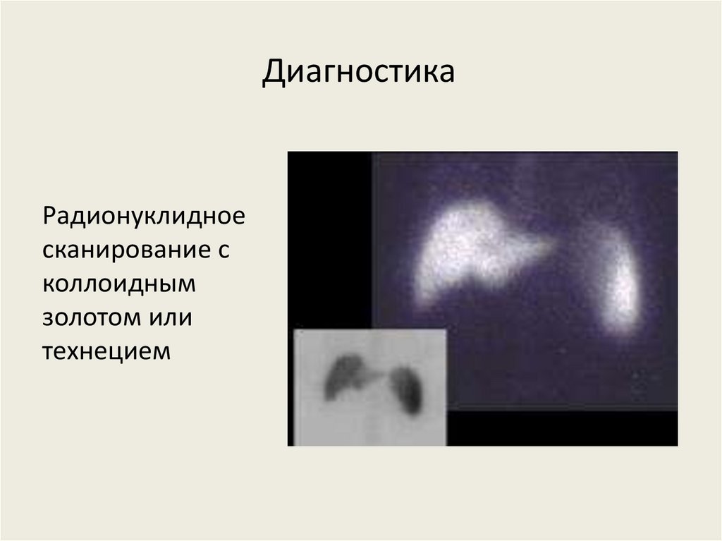 Диагностика