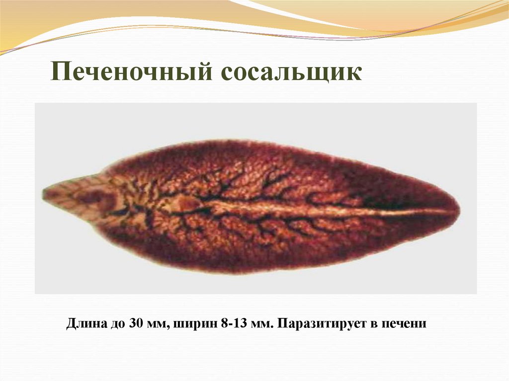 Печеночный сосальщик