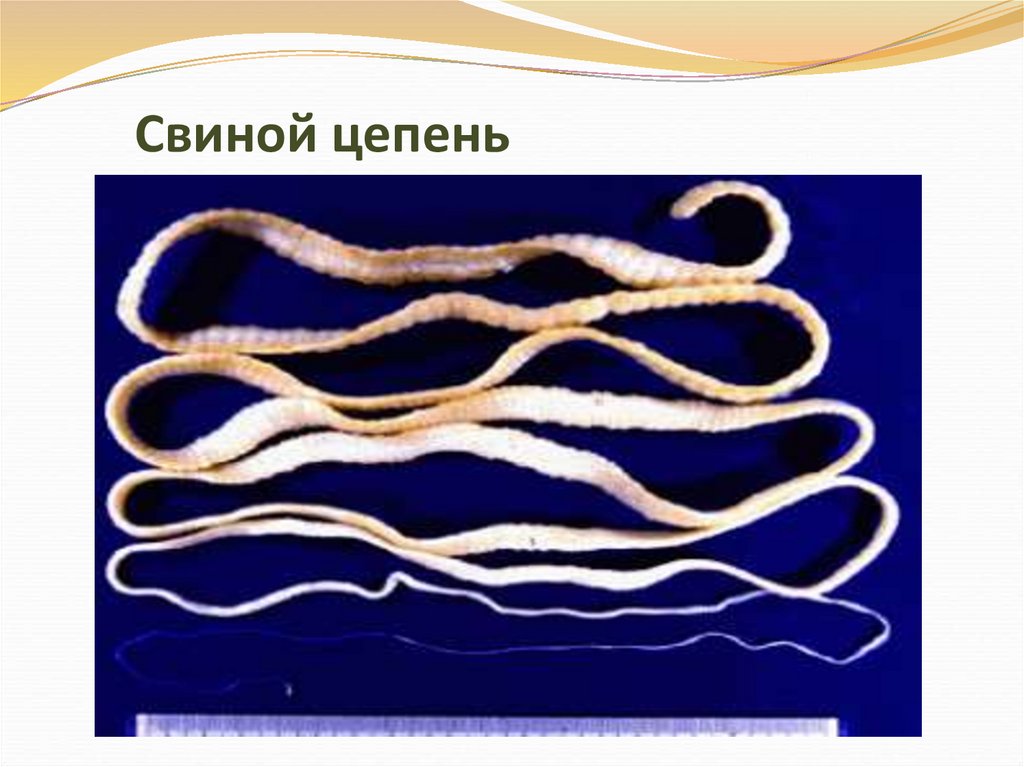 Свиной цепень