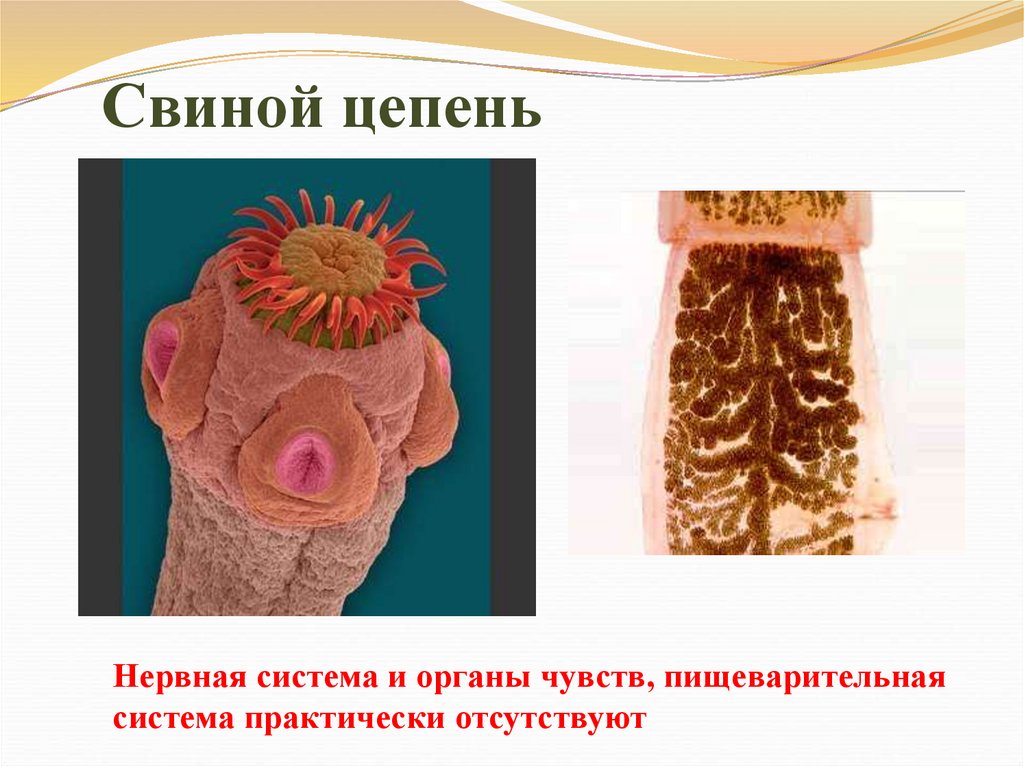 Свиной цепень