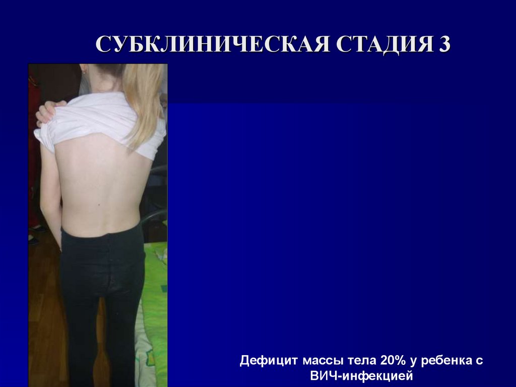 СУБКЛИНИЧЕСКАЯ СТАДИЯ 3