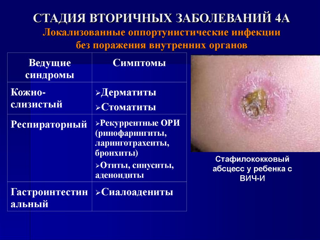 СТАДИЯ ВТОРИЧНЫХ ЗАБОЛЕВАНИЙ 4А Локализованные оппортунистические инфекции без поражения внутренних органов