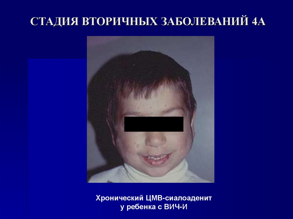 СТАДИЯ ВТОРИЧНЫХ ЗАБОЛЕВАНИЙ 4А