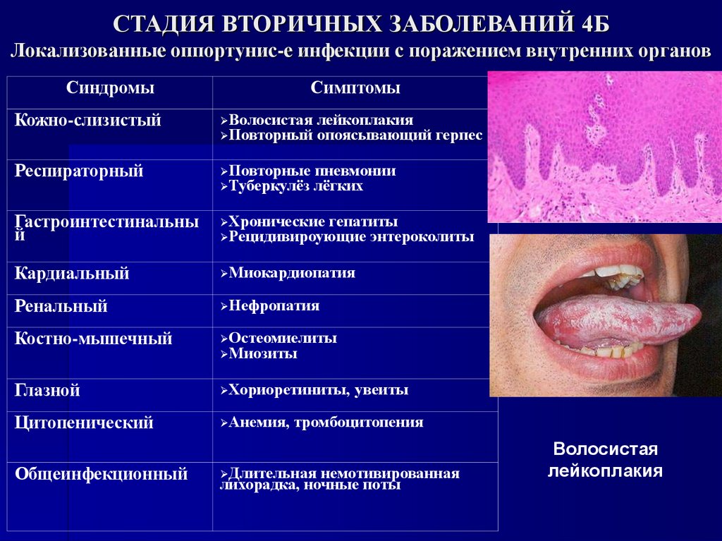 СТАДИЯ ВТОРИЧНЫХ ЗАБОЛЕВАНИЙ 4Б Локализованные оппортунис-е инфекции с поражением внутренних органов