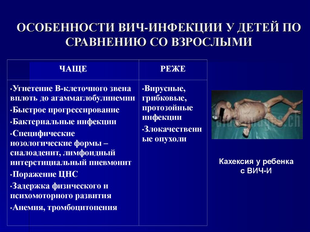 ОСОБЕННОСТИ ВИЧ-ИНФЕКЦИИ У ДЕТЕЙ ПО СРАВНЕНИЮ СО ВЗРОСЛЫМИ
