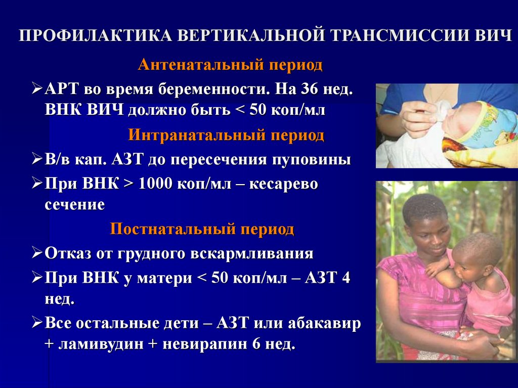 ПРОФИЛАКТИКА ВЕРТИКАЛЬНОЙ ТРАНСМИССИИ ВИЧ