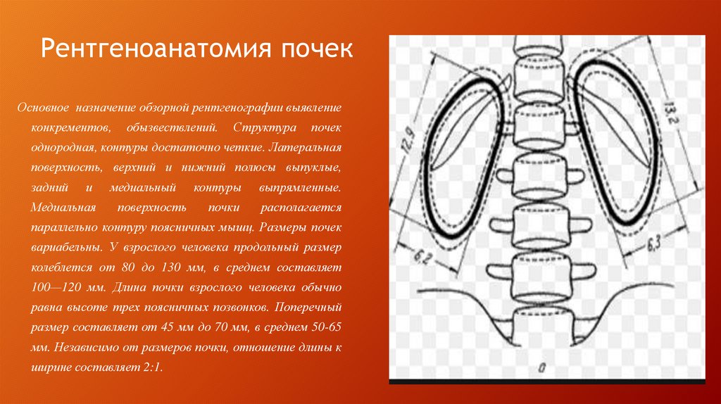 Рентгеноанатомия почек