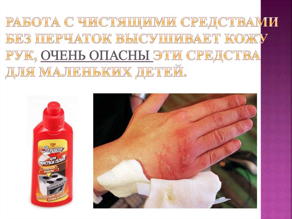 Работа с чистящими средствами без перчаток высушивает кожу рук, очень опасны эти средства для маленьких детей.