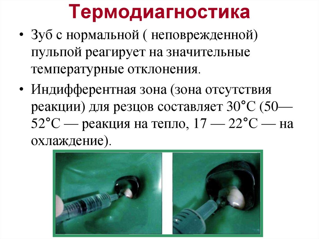 Термодиагностика