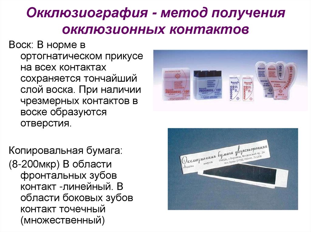 Окклюзиография - метод получения окклюзионных контактов