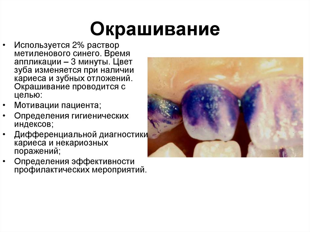 Окрашивание