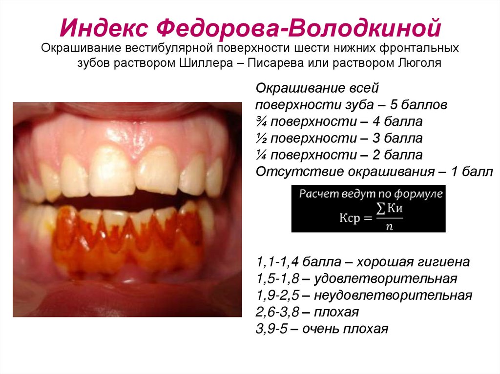 Индекс Федорова-Володкиной