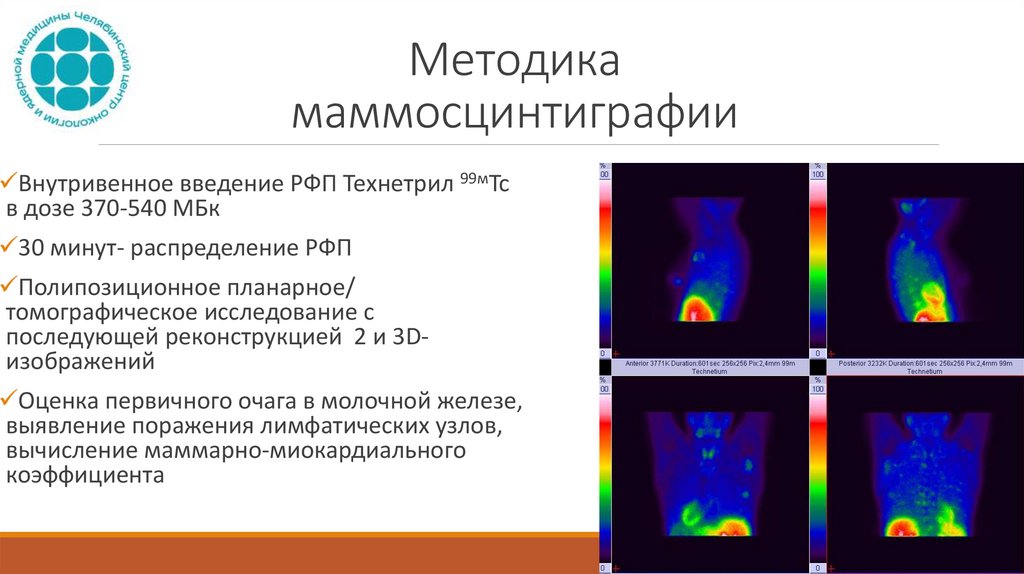 Методика маммосцинтиграфии