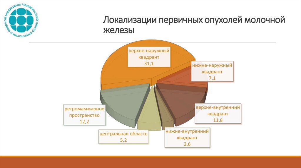 Локализации первичных опухолей молочной железы