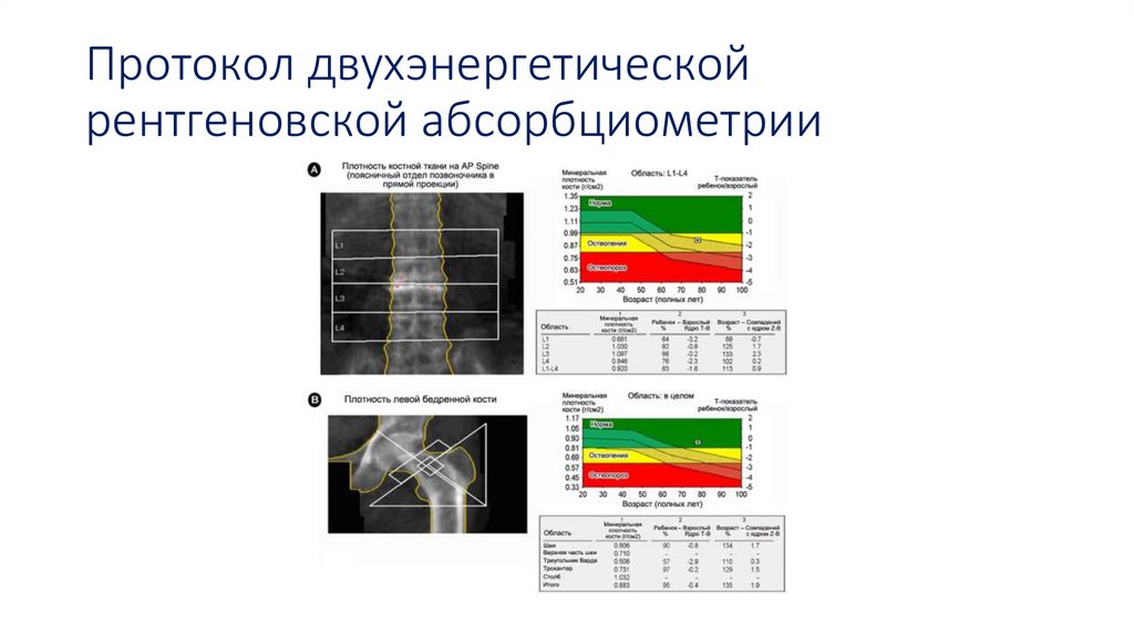 Протокол двухэнергетической рентгеновской абсорбциометрии