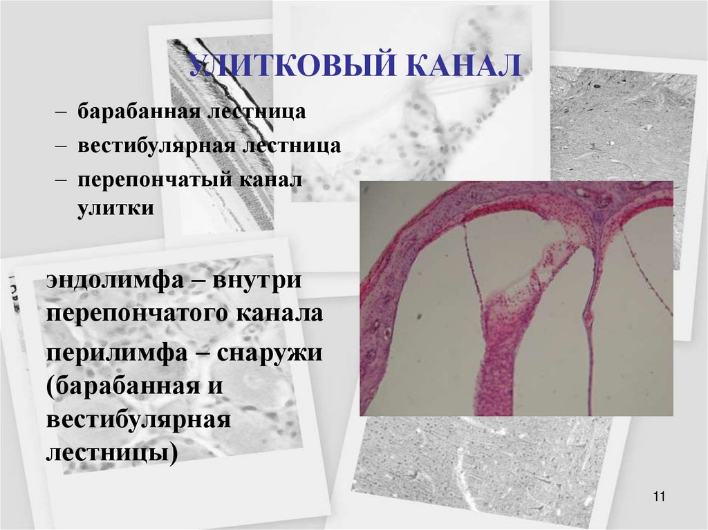 УЛИТКОВЫЙ КАНАЛ