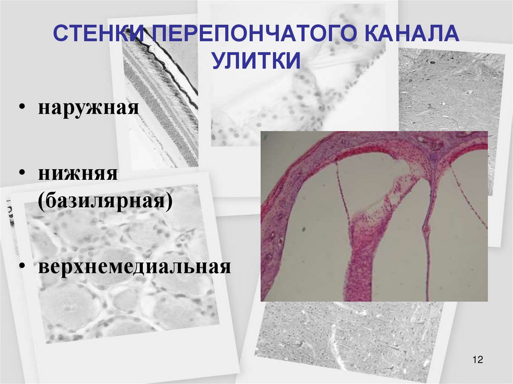СТЕНКИ ПЕРЕПОНЧАТОГО КАНАЛА УЛИТКИ