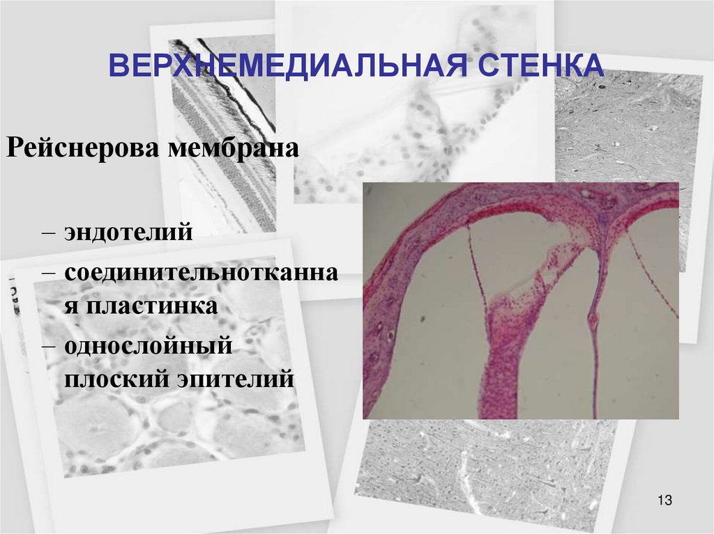 ВЕРХНЕМЕДИАЛЬНАЯ СТЕНКА