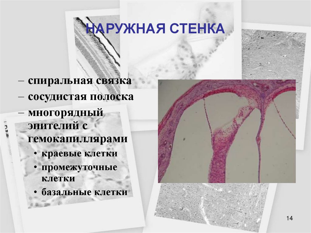 НАРУЖНАЯ СТЕНКА