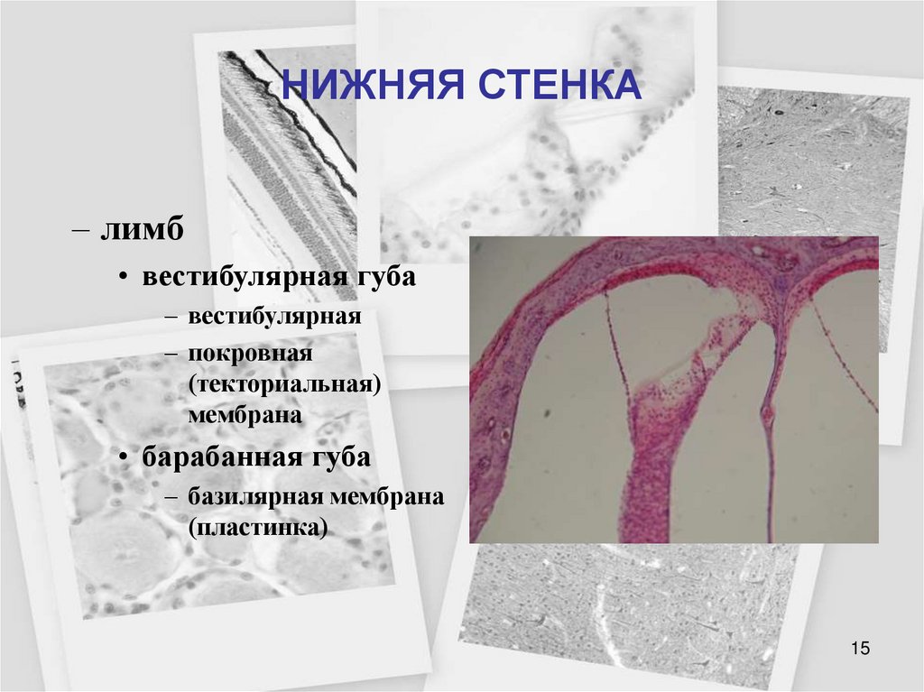 НИЖНЯЯ СТЕНКА