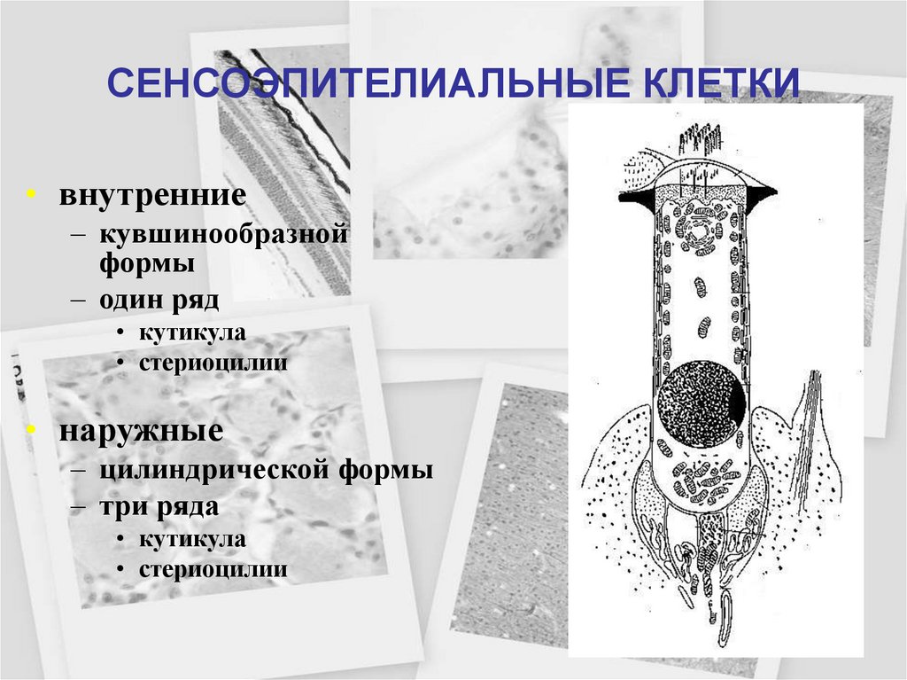 СЕНСОЭПИТЕЛИАЛЬНЫЕ КЛЕТКИ