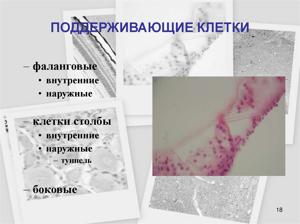 ПОДДЕРЖИВАЮЩИЕ КЛЕТКИ