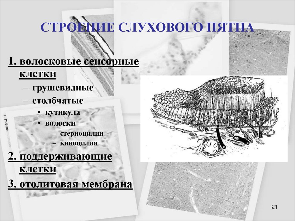СТРОЕНИЕ СЛУХОВОГО ПЯТНА
