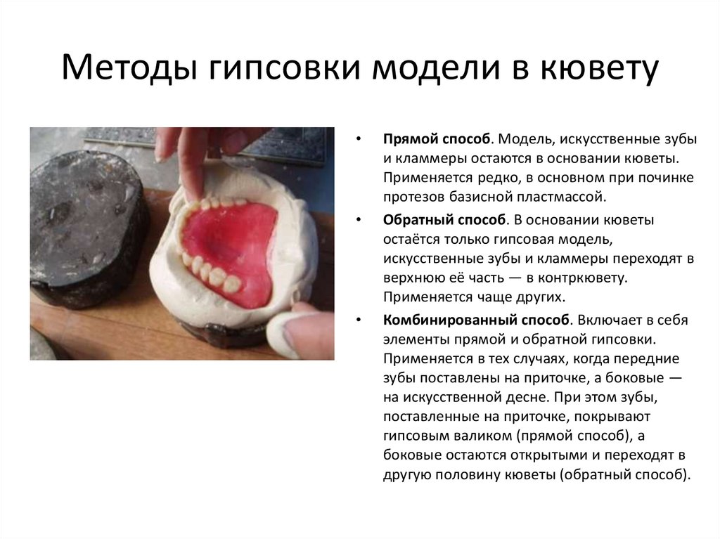 Методы гипсовки модели в кювету