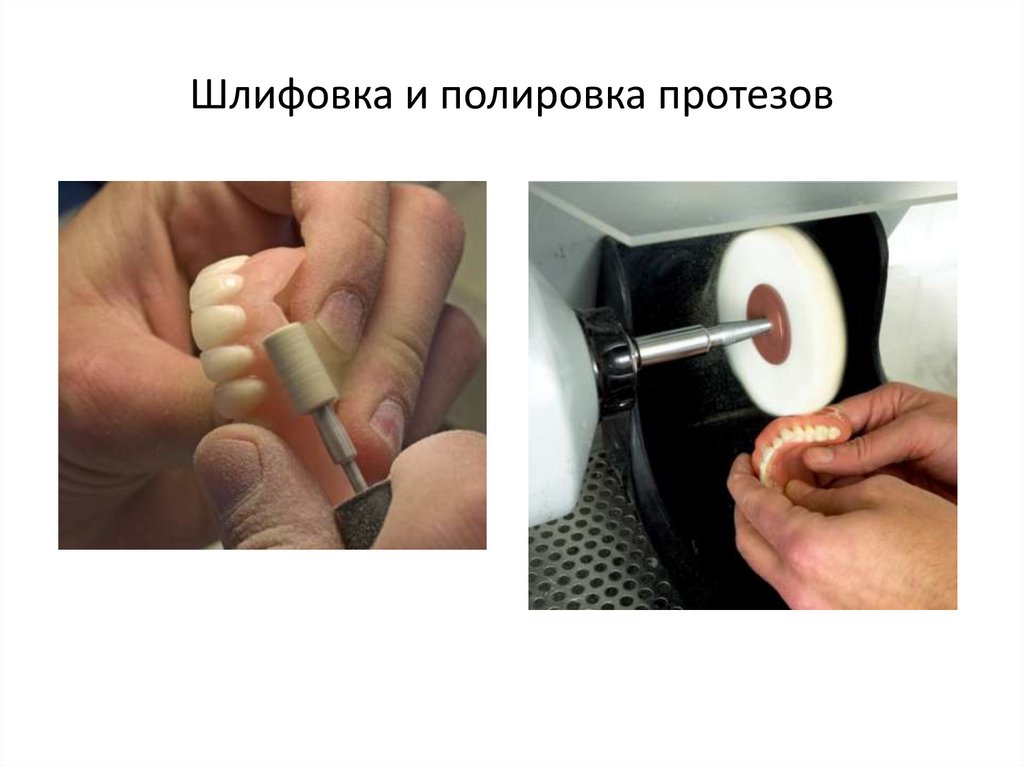 Шлифовка и полировка протезов