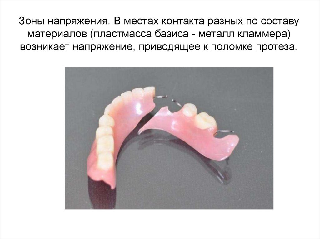 Зоны напряжения. В местах контакта разных по составу материалов (пластмасса базиса - металл кламмера) возникает напряжение,