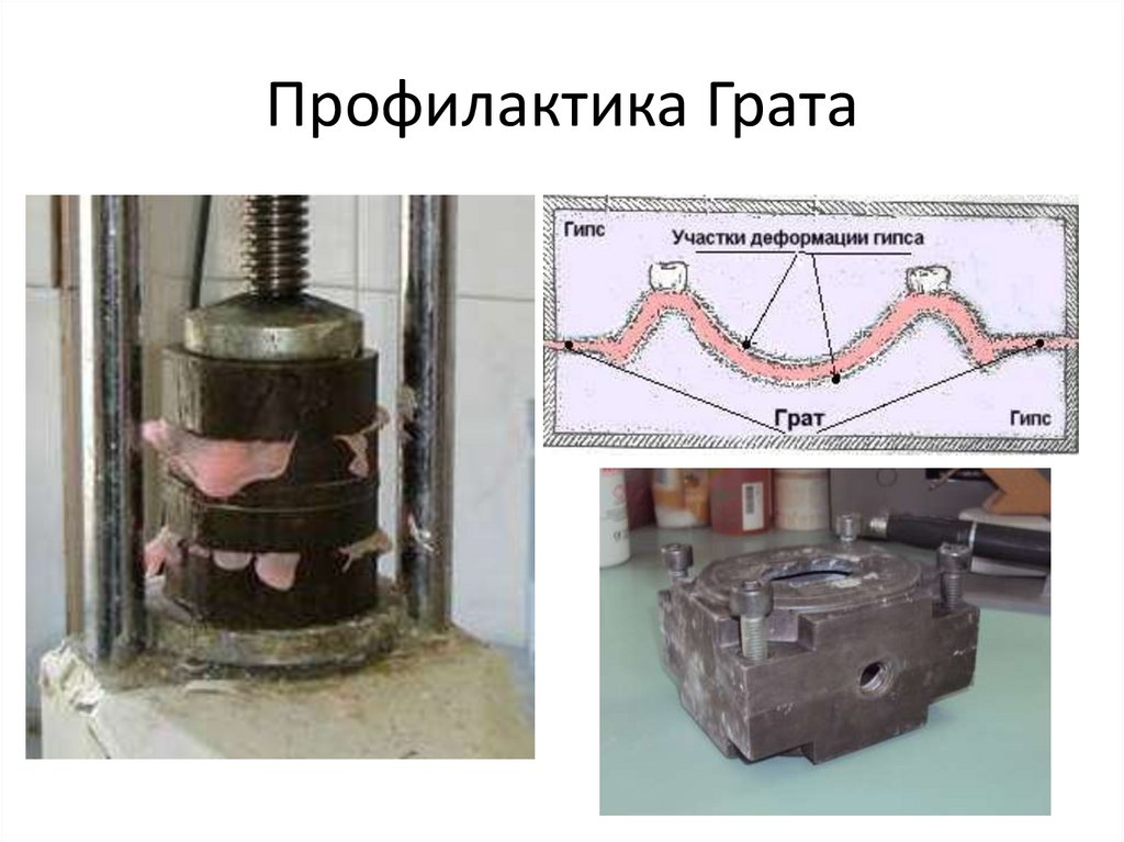 Профилактика Грата
