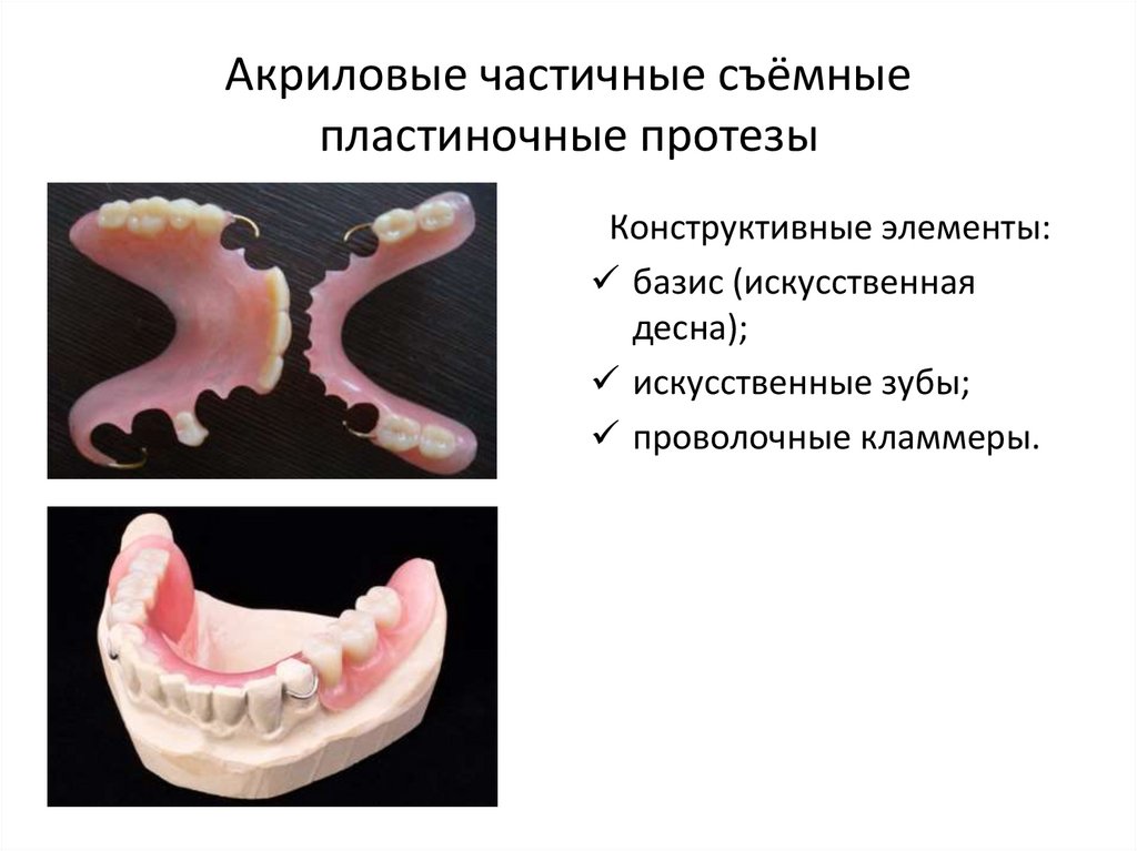 Акриловые частичные съёмные пластиночные протезы