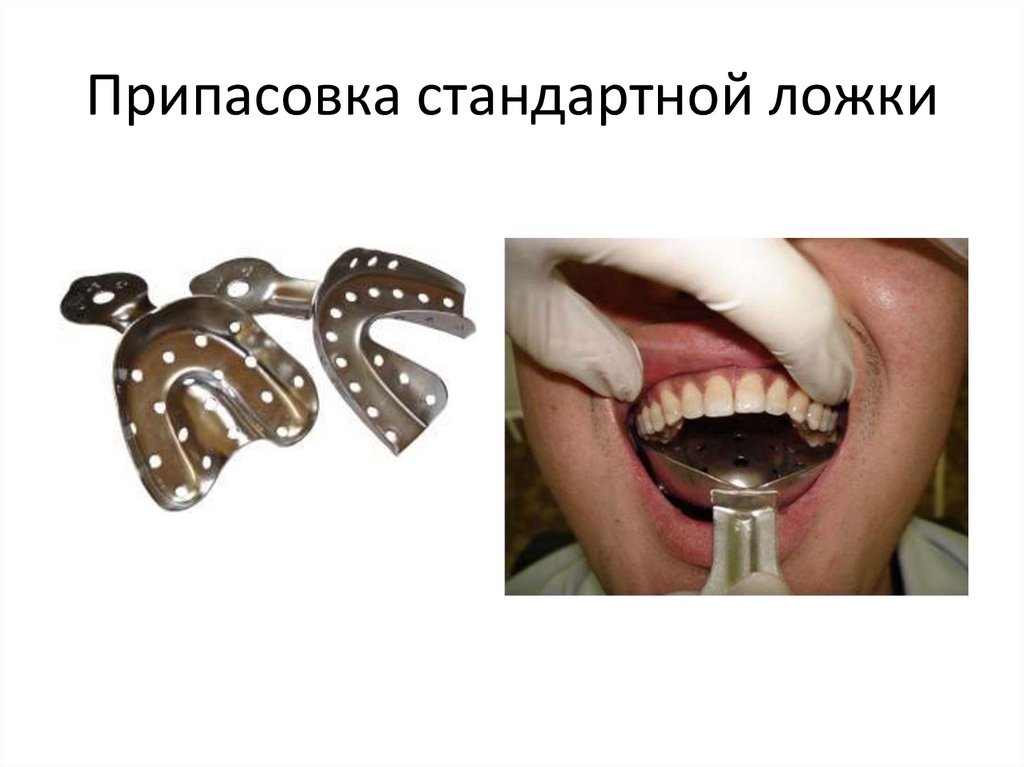 Припасовка стандартной ложки