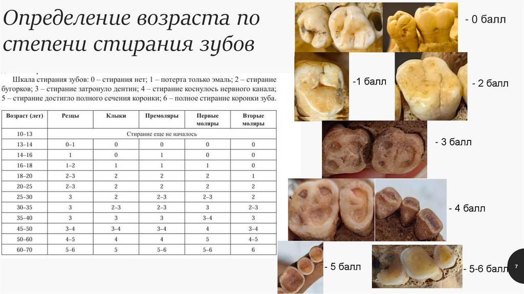 Определение возраста по степени стирания зубов
